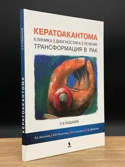 Кератоакантома. Клиника, диагностика, лечение