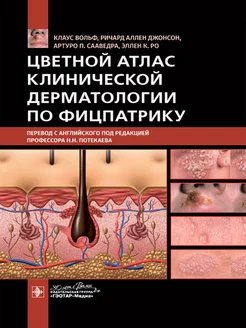 Цветной атлас клинической дерматологии по Фицпатрику